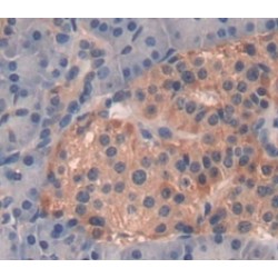 Regenerating Islet Derived Protein 1 Alpha (REG1a) Antibody