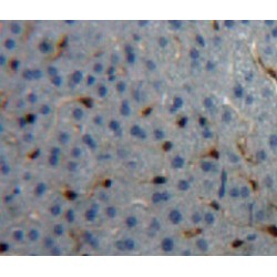 Carboxypeptidase B2 / TAFI (CPB2) Antibody