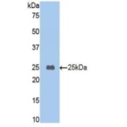 Western blot analysis of recombinant Mouse CPB2/TAFI.