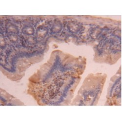 Carboxypeptidase B2 / TAFI (CPB2) Antibody