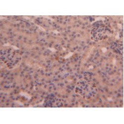 Carboxypeptidase B2 / TAFI (CPB2) Antibody