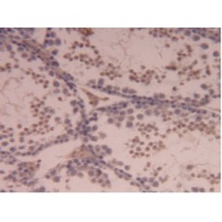 Carboxypeptidase B2 / TAFI (CPB2) Antibody