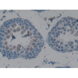 Carboxypeptidase B2 / TAFI (CPB2) Antibody