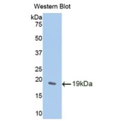 Western blot analysis of the recombinant protein.