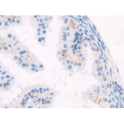 WNT1 Inducible Signaling Pathway Protein 1 / WISP1 (CCN4) Antibody