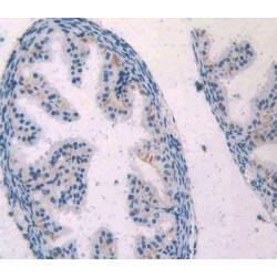 WNT1 Inducible Signaling Pathway Protein 1 / WISP1 (CCN4) Antibody