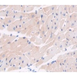 Coagulation Factor VIII Associated Protein 1 (F8A1) Antibody