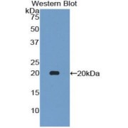 Western blot analysis of the recombinant protein.