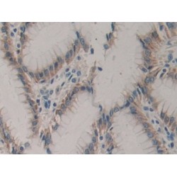 Colony Stimulating Factor 2 Receptor Alpha (CSF2Ra) Antibody