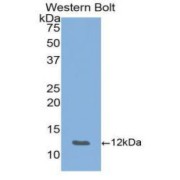 Western blot analysis of recombinant Mouse ENA78.