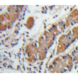 C-X-C Motif Chemokine 5 / ENA-78 (CXCL5) Antibody