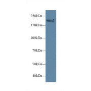 Western blot analysis of Mouse Serum, using Mouse MYH1 Antibody (1 µg/ml) and HRP-conjugated Goat Anti-Rabbit antibody (<a href="https://www.abbexa.com/index.php?route=product/search&amp;search=abx400043" target="_blank">abx400043</a>, 0.2 µg/ml).