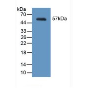 Western blot analysis of recombinant Mouse MYH2.