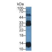 Western blot analysis of Human Lung lysate, using Human NME6 Antibody (1 µg/ml) and HRP-conjugated Goat Anti-Rabbit antibody (<a href="https://www.abbexa.com/index.php?route=product/search&amp;search=abx400043" target="_blank">abx400043</a>, 0.2 µg/ml).