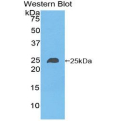 Non Metastatic Cells 6, Protein Expressed In (NME6) Antibody