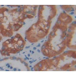 Non Metastatic Cells 6, Protein Expressed In (NME6) Antibody