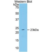 Western blot analysis of the recombinant protein.