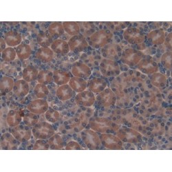 Non Metastatic Cells 6, Protein Expressed In (NME6) Antibody