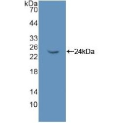 Non Metastatic Cells 6, Protein Expressed In (NME6) Antibody