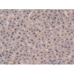 Non Metastatic Cells 6, Protein Expressed In (NME6) Antibody