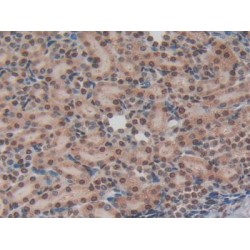 Non Metastatic Cells 6, Protein Expressed In (NME6) Antibody