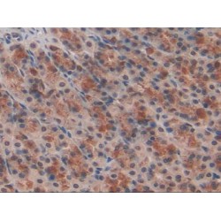 Non Metastatic Cells 6, Protein Expressed In (NME6) Antibody