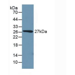 Phosphoenolpyruvate Carboxykinase, Cytosolic (PCK1) Antibody