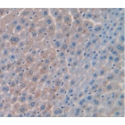 Phosphoenolpyruvate Carboxykinase, Cytosolic (PCK1) Antibody