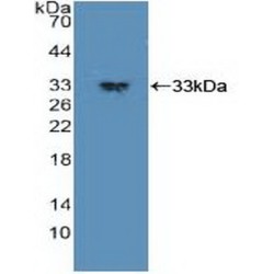 Phosphoinositide Dependent Protein Kinase 1 (PDPK1) Antibody