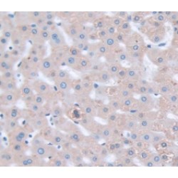 Phosphoinositide Dependent Protein Kinase 1 (PDPK1) Antibody