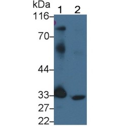 Programmed Cell Death 1 Ligand 1 (CD274) Antibody