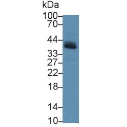 Programmed Cell Death 1 Ligand 1 (CD274) Antibody