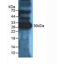 Programmed Cell Death 1 Ligand 1 (CD274) Antibody