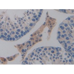 Programmed Cell Death 1 Ligand 1 (CD274) Antibody