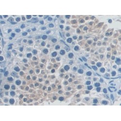 Receptor Activator of Nuclear Factor Kappa B (RANk) Antibody