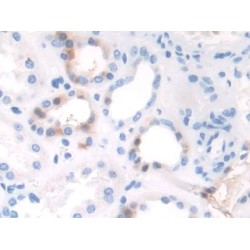 TATA Box Binding Protein Associated Factor 1 (TAF1) Antibody