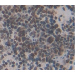 V-Myc Myelocytomatosis Viral Oncogene Homolog (MYC) Antibody