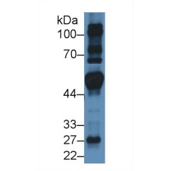 Fibroblast Growth Factor Receptor Substrate 2 (FRS2) Antibody