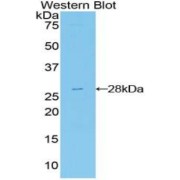 Western blot analysis of recombinant Human FRS2.