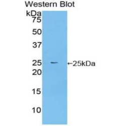 Fibroblast Growth Factor Receptor Substrate 2 (FRS2) Antibody