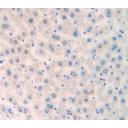 Fibroblast Growth Factor Receptor Substrate 2 (FRS2) Antibody