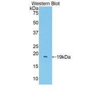 Western blot analysis of the recombinant protein.