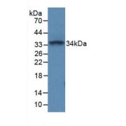 Western blot analysis of recombinant Mouse PTPRC.