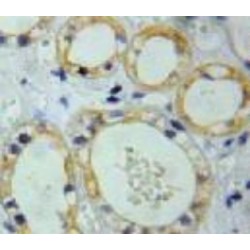 Receptor-Type Tyrosine-Protein Phosphatase C / CD45 (PTPRC) Antibody