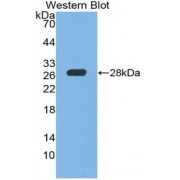 Western blot analysis of recombinant Mouse PTPRS Protein.
