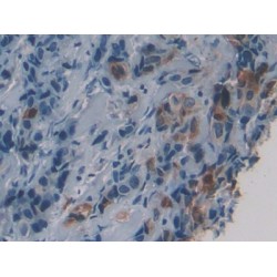 17-Beta-Hydroxysteroid Dehydrogenase Type 1 (HSD17b1) Antibody