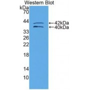 Western blot analysis of recombinant Human IGFBP1.