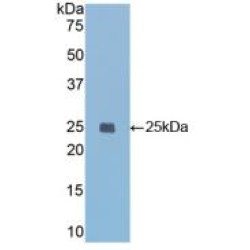 Insulin Like Growth Factor Binding Protein 7 (IGFBP7) Antibody