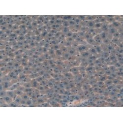 Insulin Like Growth Factor Binding Protein 7 (IGFBP7) Antibody