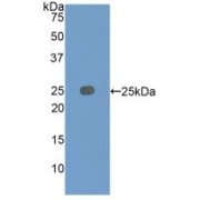 Western blot analysis of recombinant Rat IGFBP7.